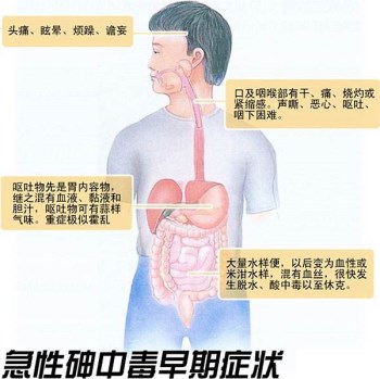 儿童微量元素检测仪分析砷中毒的危害?山东国康