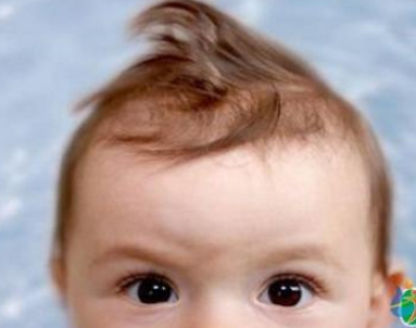 微量元素分析仪检测宝宝头发黄是否是体内缺乏微量元素